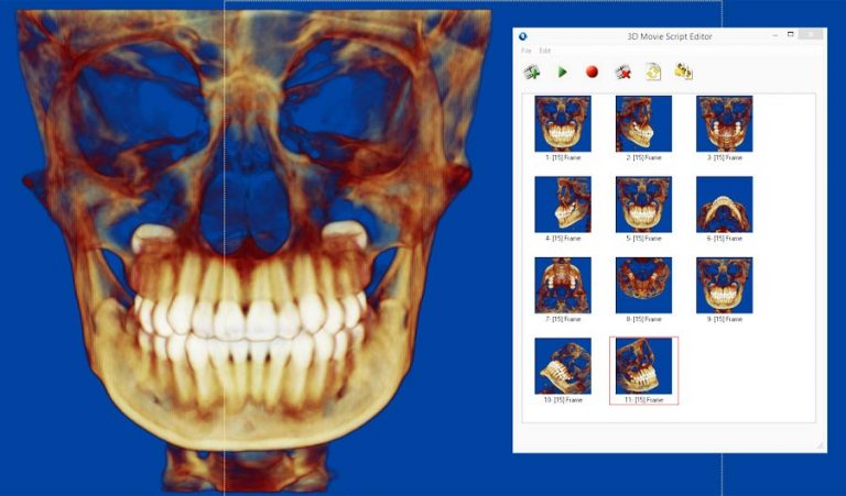 Как загрузить dicom файлы в dolphin imaging