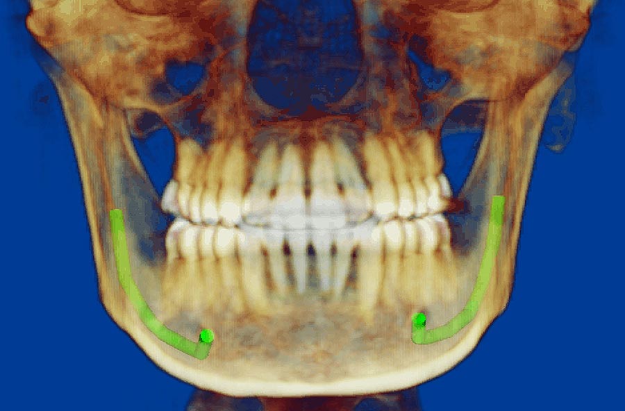 Как загрузить dicom файлы в dolphin imaging