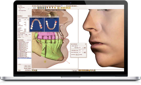 Как загрузить dicom файлы в dolphin imaging