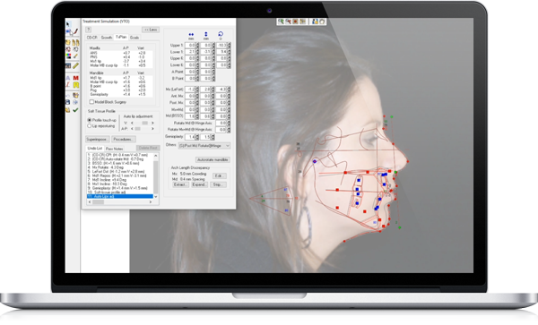 Как загрузить dicom файлы в dolphin imaging